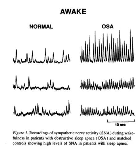 Sympath aktivitaet bei sas wach