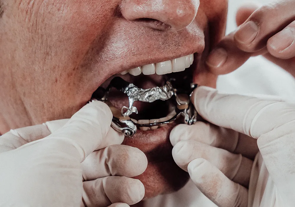 Herstellung Anpassung Protrusionsschiene