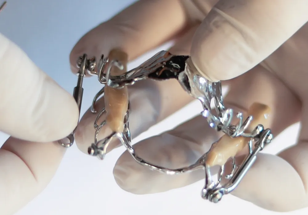 Nachkontrolle, Nachjustierung, Protrusionsschiene, Schlafapnoe