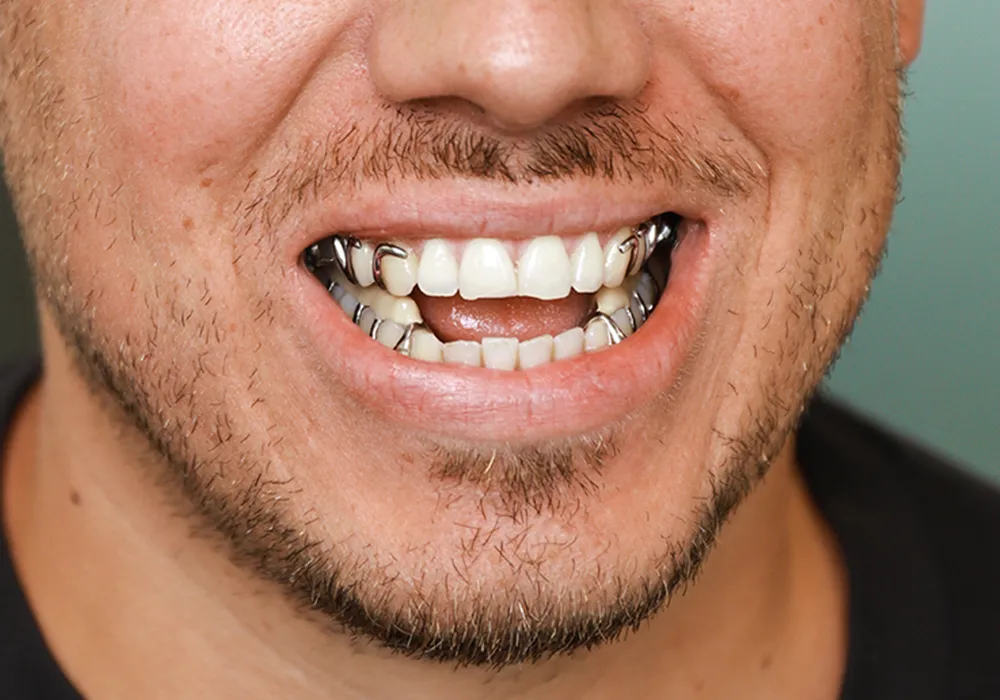 Perfekter sitz hoher tragekomfort apnoeperfect